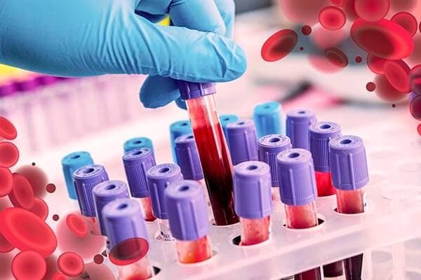 Guía práctica: Qué significan los resultados de tu hemograma